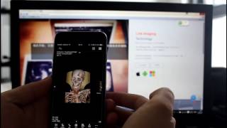 LinkCloud Mobile dicom viewer [upl. by Adniles]