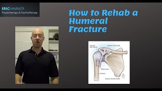 How to Rehab a Humeral Fracture [upl. by Tadd]