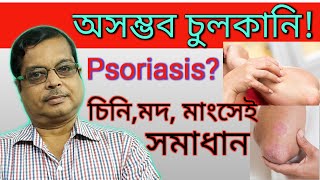 Psoriasis in Bengali  Discussion and Treatment in Homeopathy  সম্পূর্ণ চিকিৎসা  Home remedies [upl. by Merola671]