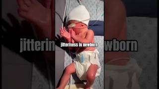 Medical education video neonatology jitteriness in newborn 👶🏻 jitteriness vs seizure shorts yt [upl. by Asylla]