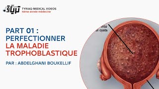 PART 01 PERFECTIONNER LA MALADIE TROPHOBLASTIQUE  mole hydatiforme   PAR  ABDELGHANI BOUKELLIF [upl. by Chrisse]