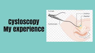 Cystoscopy experience NHS wales [upl. by Hungarian]