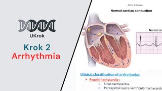 KROK 2  Arrhythmia All Types amp related NEW Krok questions [upl. by Yecam]