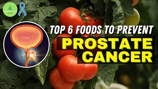 TOP 6 Foods To PREVENT Prostate Cancer You Should Eat [upl. by Ayna]