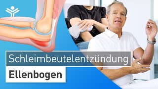 Schleimbeutelentzündung am Ellenbogen Bursitis – Schwellung selbst behandeln oder sofort zum Arzt [upl. by Othella771]