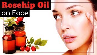 Rosehip Oil on Face How to Use It [upl. by Emse]