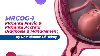 MRCOG1  Placenta Previa amp Placenta Accreta  Diagnosis amp Management  By Dr Muhammad Helmy [upl. by Lokim743]