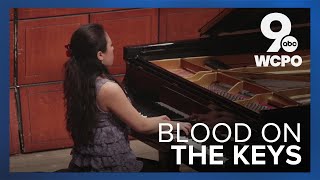 Bloody piano keys Pianist says it doesnt hurt actually [upl. by Dunning184]