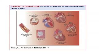 Anticoagulation Post Stroke Who What When [upl. by Batchelor]