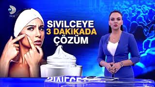 Sivilceye karşı 3 dakikada kesin cözüm [upl. by Ennairak205]