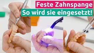 Feste Zahnspange So wird sie in den Mund eingesetzt [upl. by Noraf]