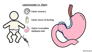 Pyloric stenosis step by step pylorus ultrasound Pyloric hypertrophic [upl. by Waterman]