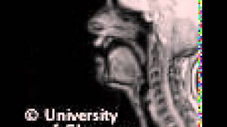 MRI voiceless postalveolar fricative [upl. by Nimesay33]