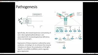 Basics of Renal Pathology  IgA Nephropathy [upl. by Odlo]