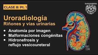 081  Uroradiología  Anatomía por imagen y malformaciones congénitas [upl. by Yelra]